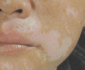 人ҽԺϺã˰Ժκ